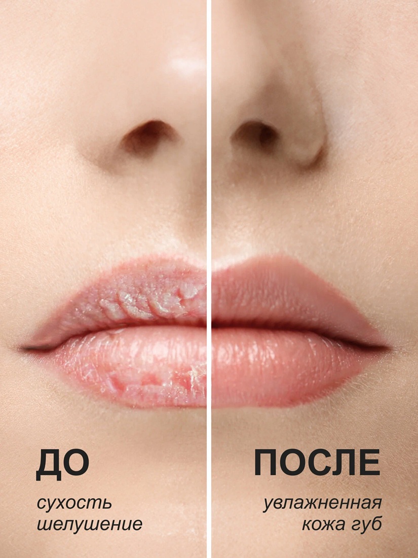 Бальзам для губ питательный «Extreme Lips» | МиКо